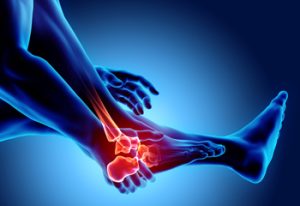 آیا آرتروز همان ساییدگی است؟