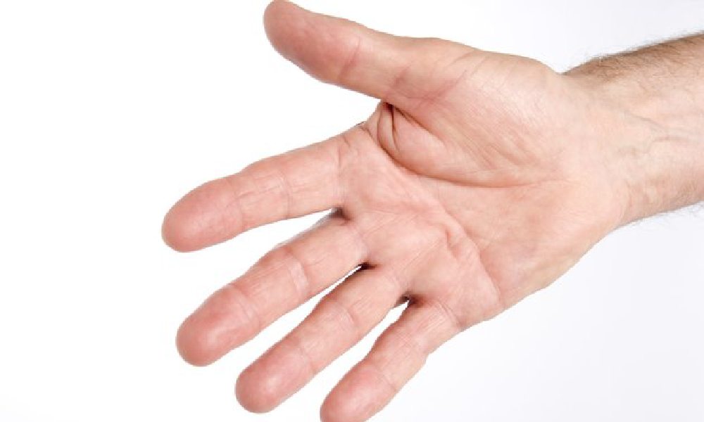 تومور انگشت