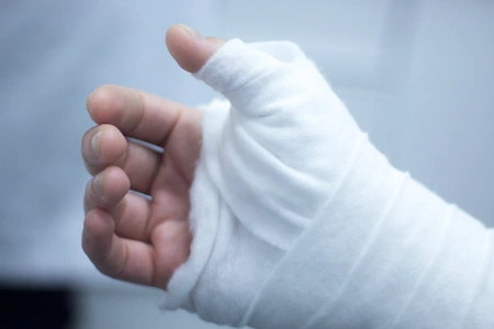 جراحی مچ دست برای رفع اختلالات حرکتی