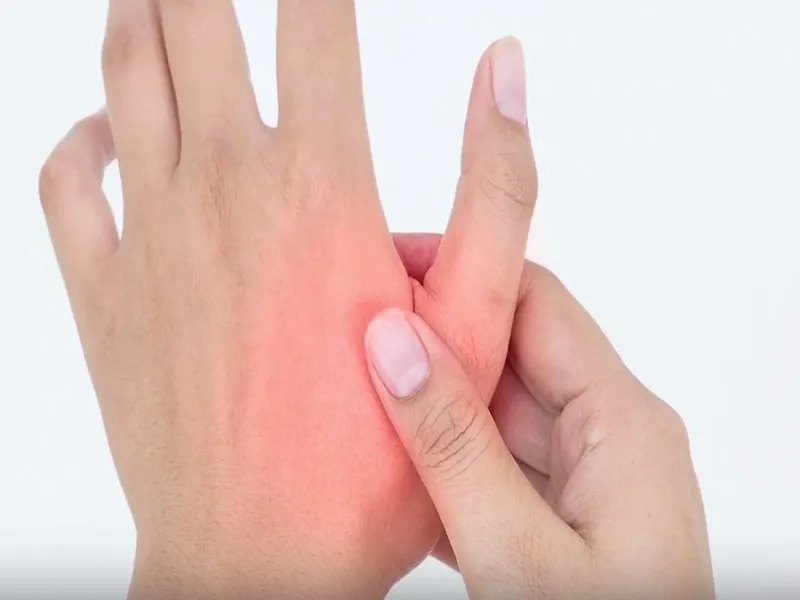 آرتروز انگشت شست دست