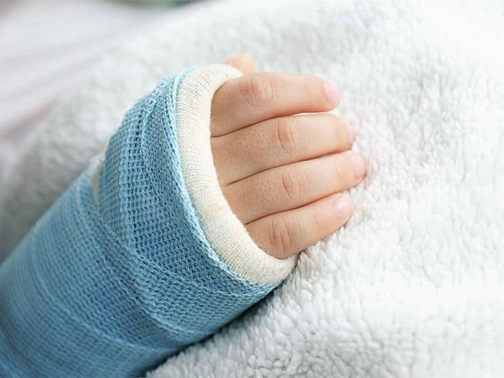 عوارض شکستگی اسکافوئید