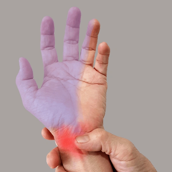 علل بروز سندروم تونل گویان