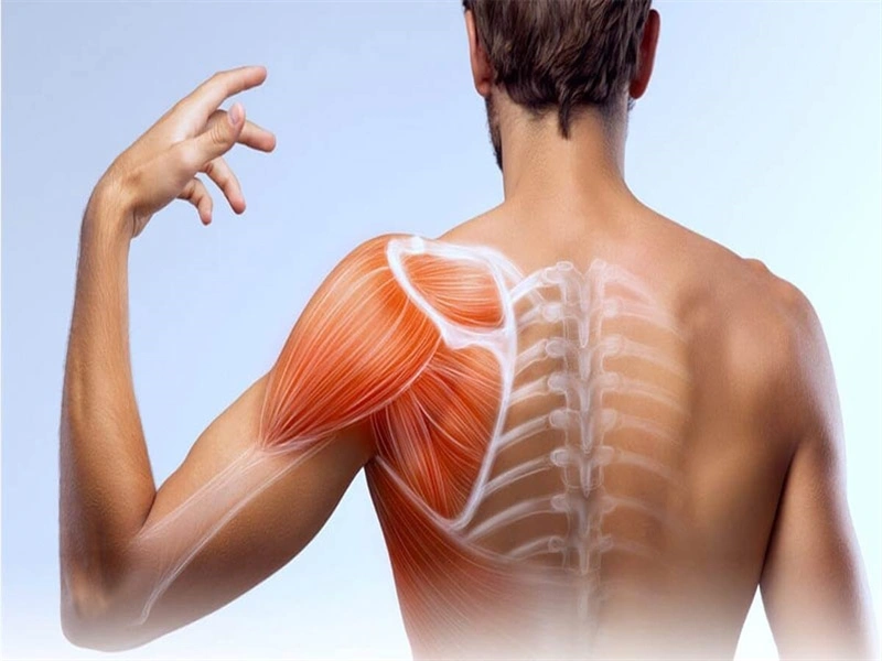 علائم اولیه پارگی تاندون شانه