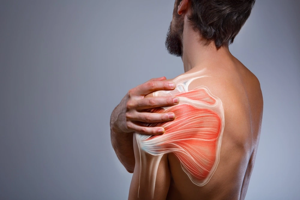 علائم سندروم گیر افتادگی شانه