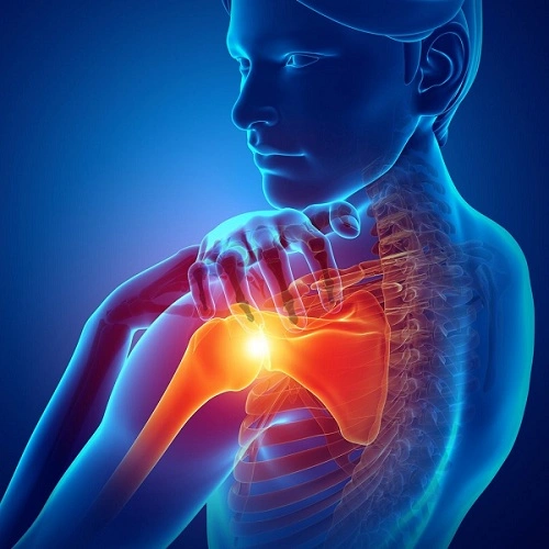 پیشگیری از التهاب تاندون شانه